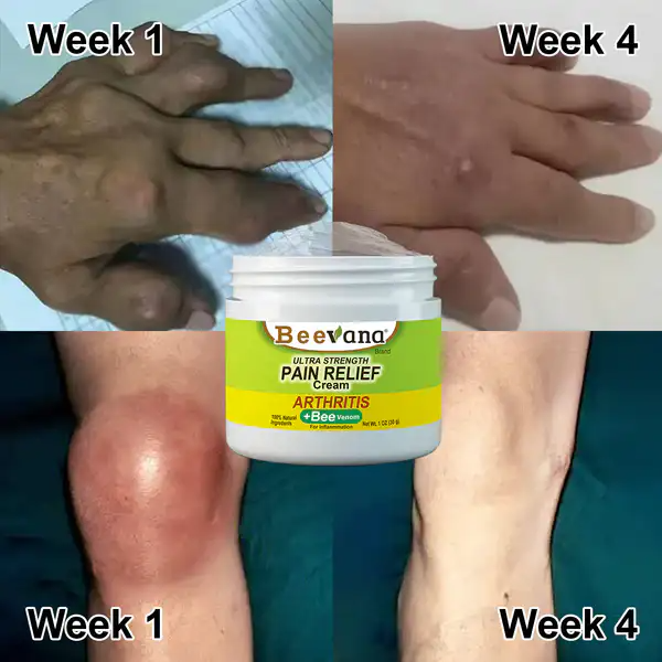 Crema Beevana™ con Veneno de Abeja – Alivio Natural para Dolores y Articulaciones COMBO 2 UNIDADES POR 1